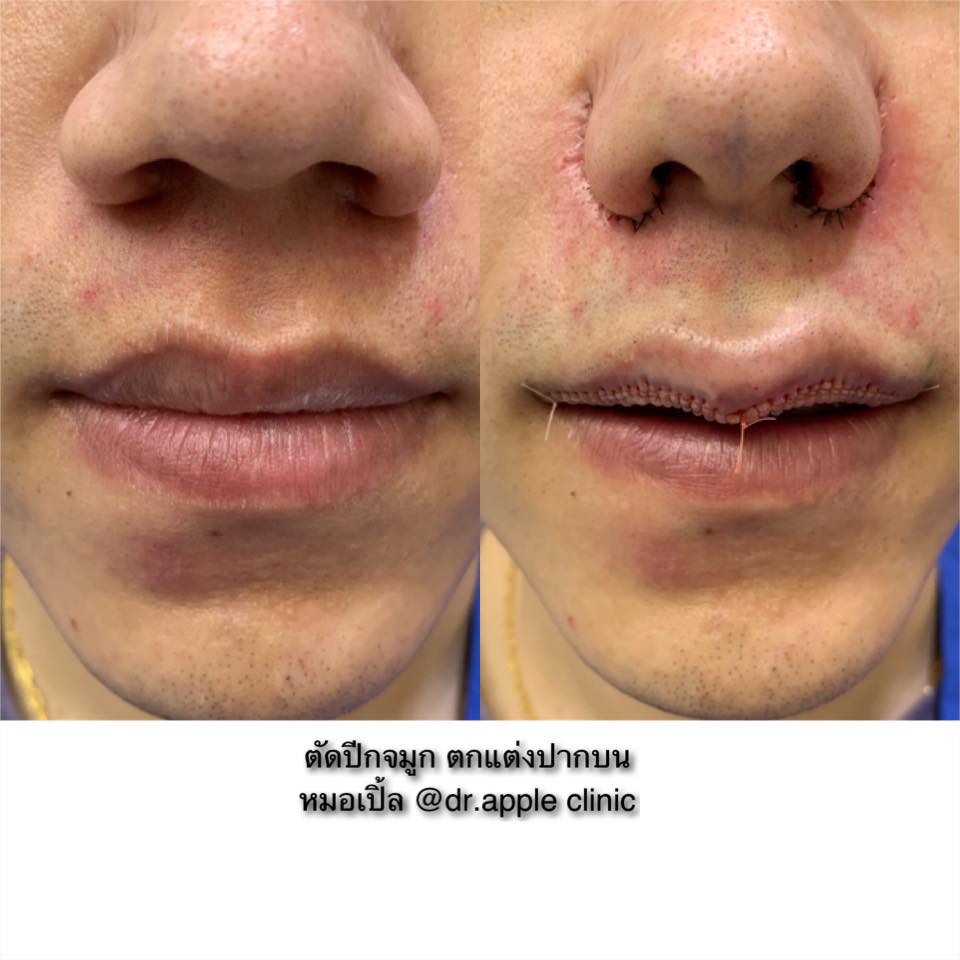 ผู้ชาย ทำศัลยกรรม แปลกหรือไม่?, คลินิคศัลยกรรมความงาม โดย นายแพทย์ พลศักดิ์ วรไกร (หมอเปิ้ล)
